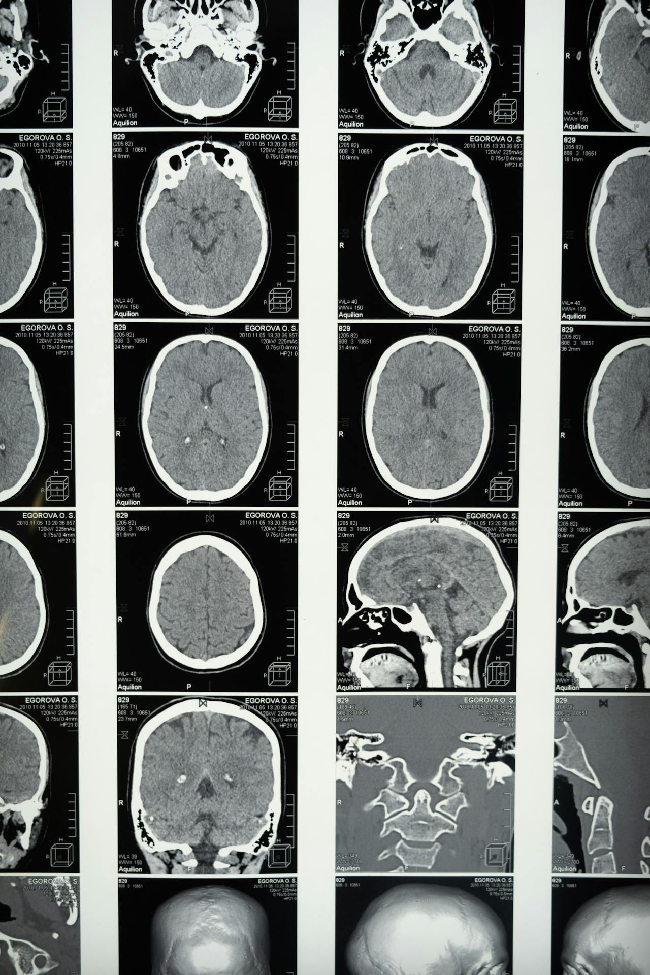Head Injury / Trauma Surgery
