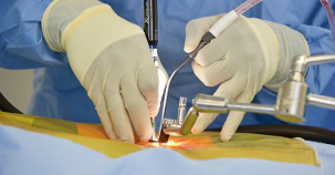 Minimally Invasive Spine Surgery