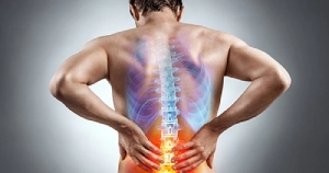 Sciatica Treatment